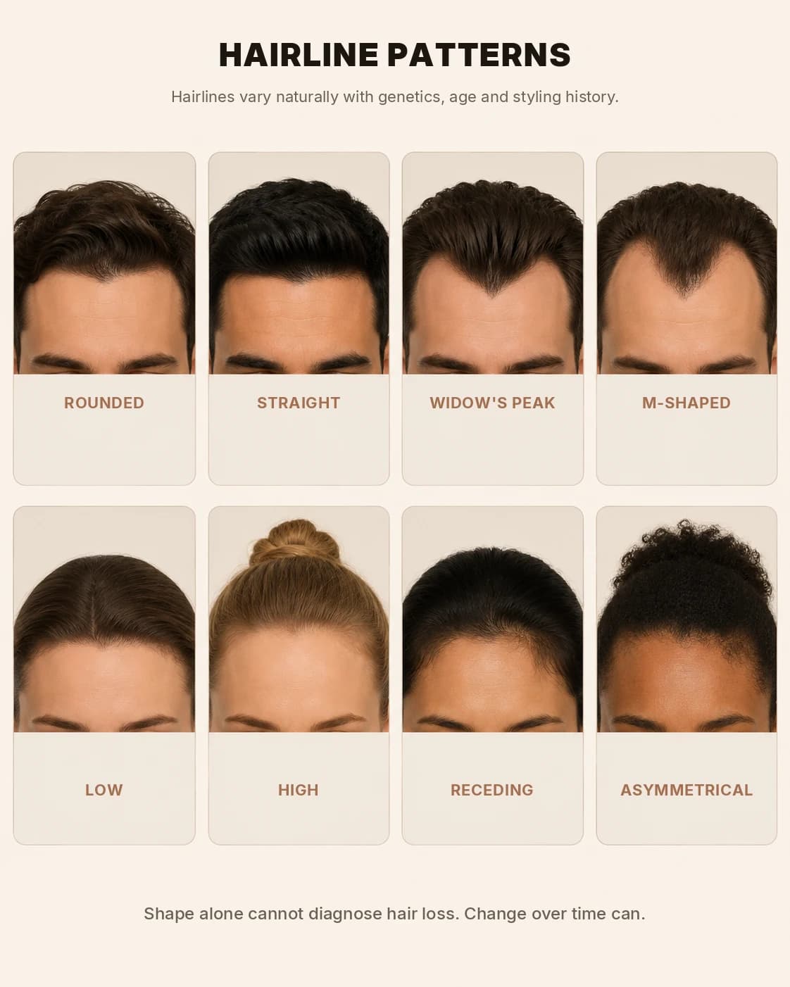 Eight common hairline patterns compared side by side