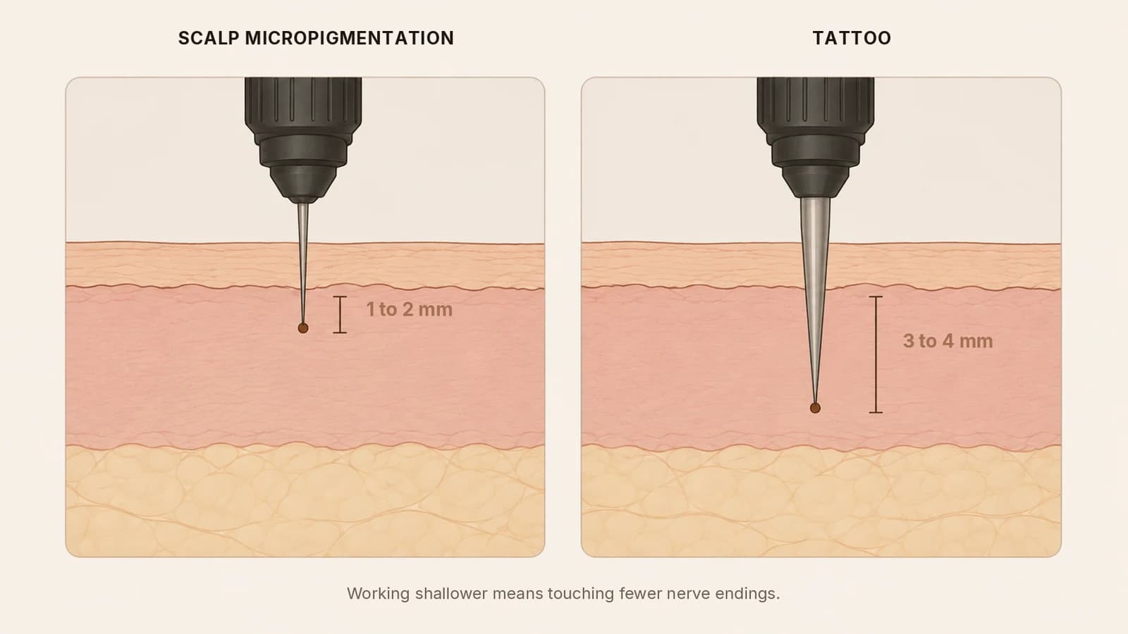 Cross-section of skin comparing needle depth in SMP and in tattooing
