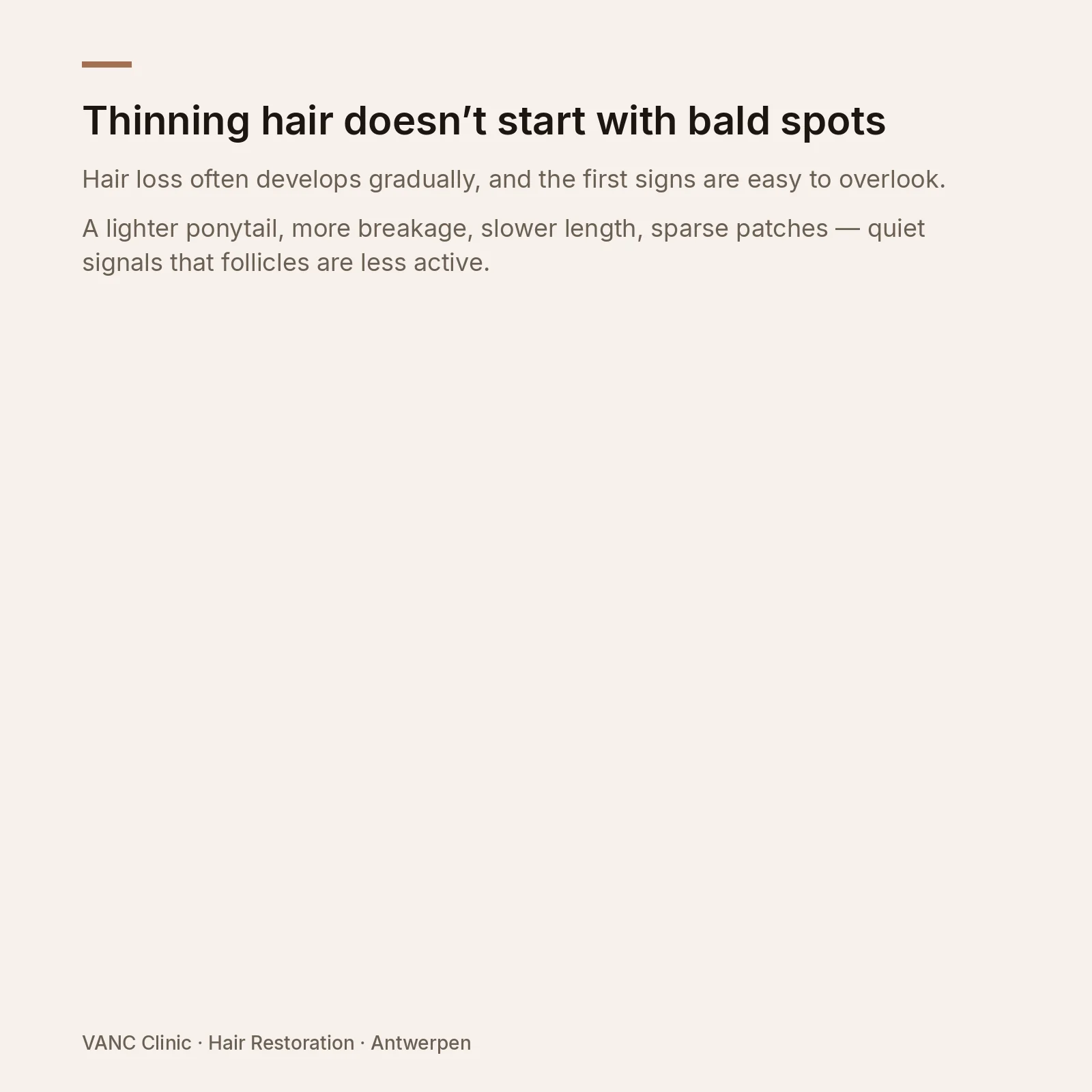 VANC Clinic note — thinning hair often starts before visible bald spots
